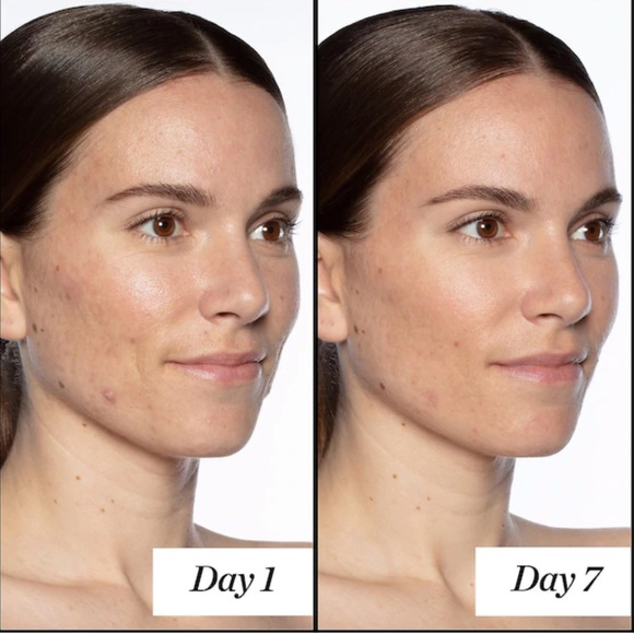 🌿SUNDAY RILEY Good Genes All-In-One Lactic Acid - Picture 7 of 11